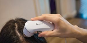 頭皮護理的重要性：案例分享與實踐指南